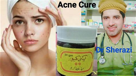 Acne Cure Cream Ance Pimples How To Cure Face Fleck Homeopathic