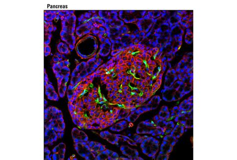 Phospho Vegf Receptor Antibody Sampler Kit Cell Signaling Technology