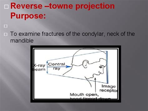 Extraoral Radiographic Technique Extraoral Radiograph Is Defined As