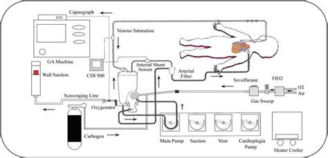 Schematic diagram of cardiopulmonary bypass circuit with carbogen ...