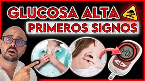 ¡9 SÍntomas Que Avisan De Glucosa Alta ¿tienes Una Diabetes Youtube