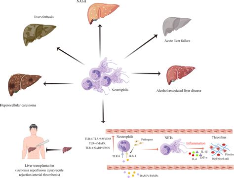 Frontiers Neutrophil Extracellular Traps And Complications Of Liver