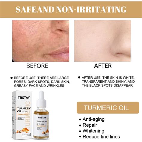 Turmeric Melasma Whitening Correcting Serum Facial Care Essence Oil