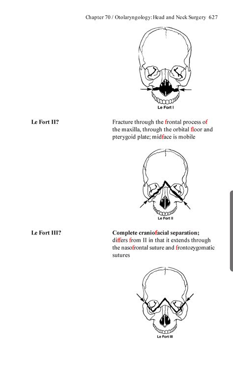 Surgical Recall 7th Edition Best Medical Books 72 Chapter 70