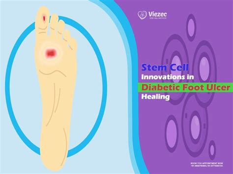 Stem Cell Innovations In Diabetic Foot Ulcer Healing In India
