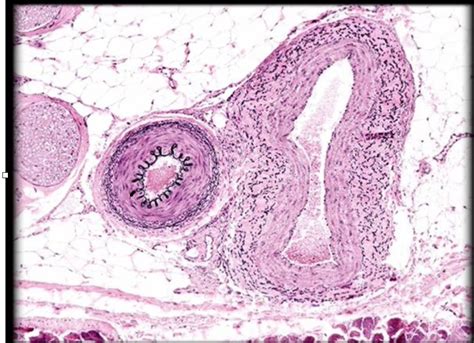 Blood vessel histology model Diagram | Quizlet