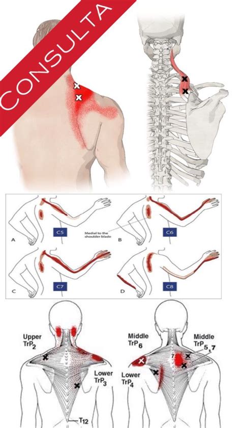 Pin De Body Soul Therapy Alberta C En Anatomia Musculos Puntos De