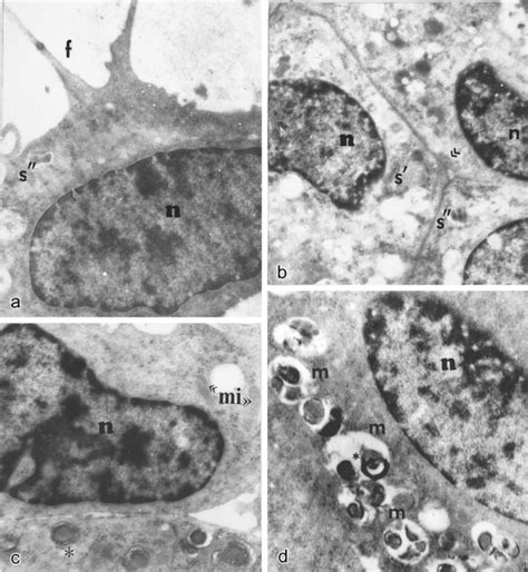 A And B Control C Glioma Cells Bear Oval Nuclei N With Around