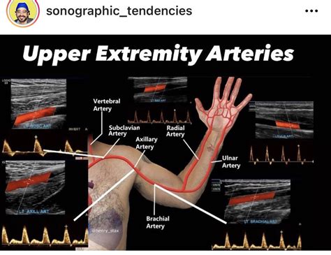 Lower extremity venous and arterial ultrasound – Artofit