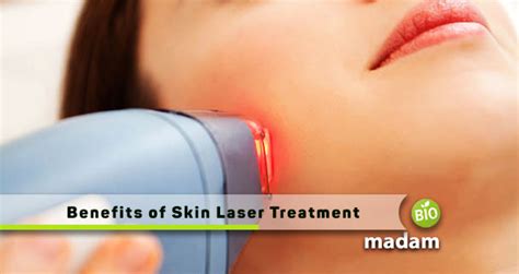 Top Benefits Of Skin Laser Treatments That You Didn T Know About Biomadam