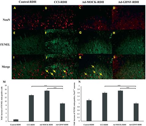 Double Immunofluorescent Staining Of TUNEL And A Neuronal Cell Marker