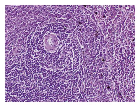 Photomicrographs Of H And E Stained Sections Of Spleen Of The Different