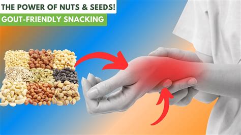 Say Goodbye To Gout With Nuts And Seeds Youtube