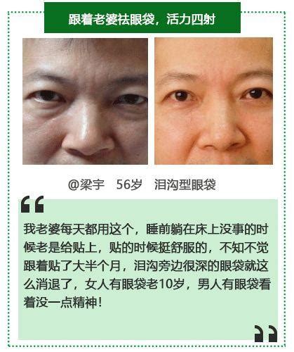 60歲都沒有眼袋、眼紋，僅需睡前貼個它！ 每日頭條