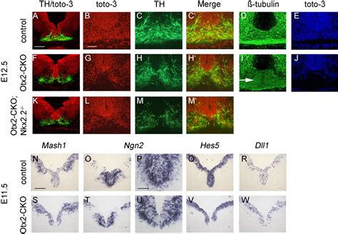 Otx Regulates Subtype Specification And Neurogenesis In The Midbrain