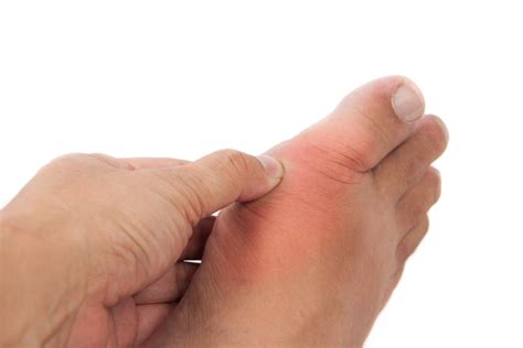 8 Possible Reasons For Big Toe Pain And What To Do About Them