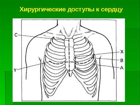 Операции на грудной клетке