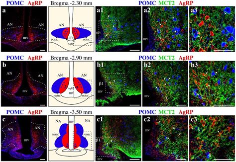 Mct Is Localized In Both Agrp And Pomc Neurons Of The Arcuate Nucleus