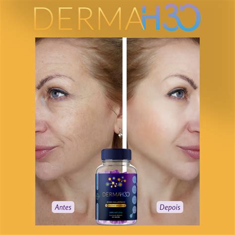 Derma H Funciona Mesmo Onde Comprar Pre O Site Oficial