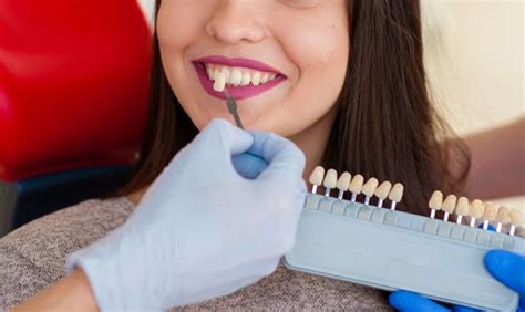 Can Veneers Fix Gaps Between Teeth? What You Should Know