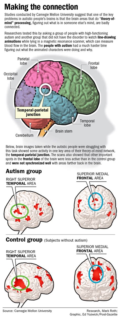 Autism And Brain Development