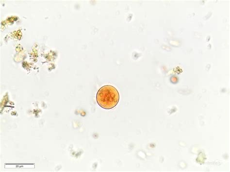 Parasitología Controllab