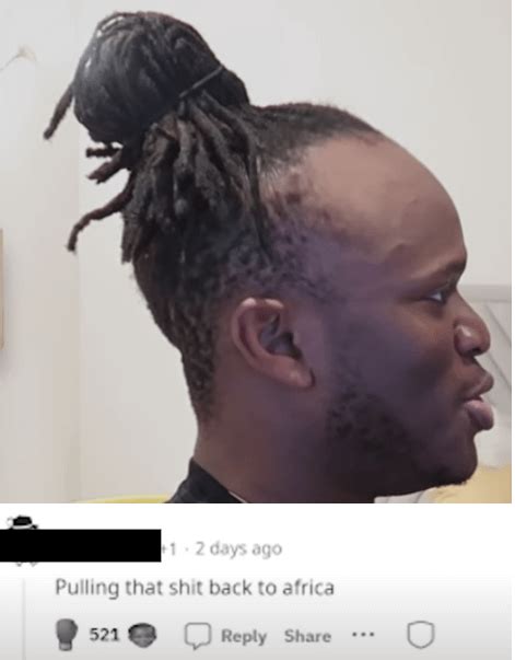 Cursedksis Hair Line Rcursedcomments