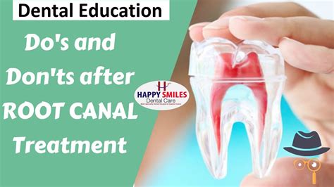 Dos Donts After Root Canal Treatment Precautions After Root Canal