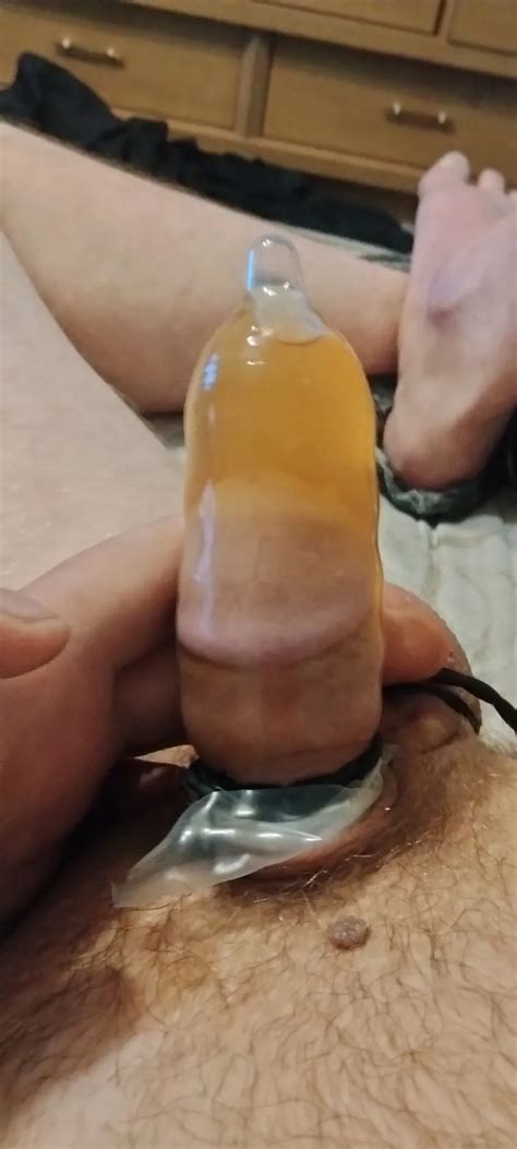 Spun And Filling A Condom With My Dirty Chem Tasty Piss Nude Pics XHamster