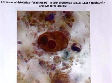 Entamoeba Histolytica Fecal Smear In Your Description Include What A Trophozoite And Cyst Form