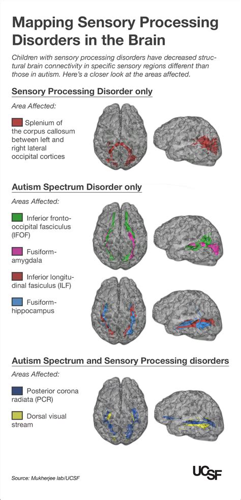 Autism Brain Structure