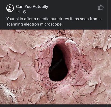 A Pink Wall With A Hole In It That Says Can You Actually Tell If Your Skin After A Needle