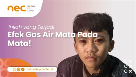 Waspada 5 Bahaya Gas Air Mata Tear Gas