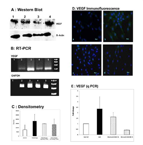 A Western Blot For Vegf Protein And The Beta Actin Control The Lanes Download Scientific