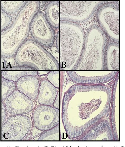 Figure From Immunolocalization Of Androgen Receptor In The Epididymis