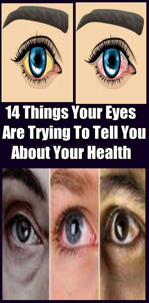 14 Things Your Eyes Are Trying To Tell You About Your Health