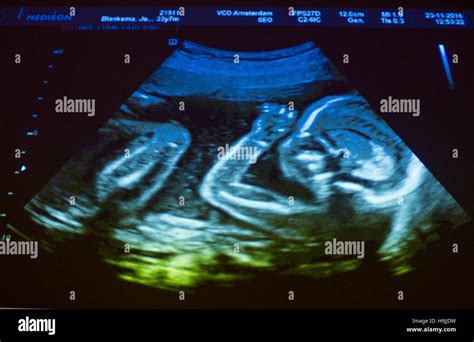 Pregnant Ultrasound – Telegraph