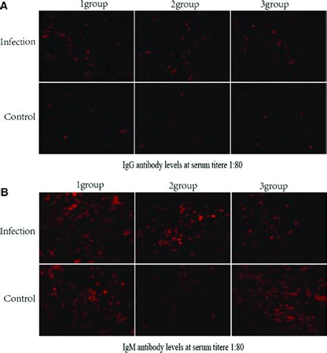 Indirect Immunofluorescence Assay Of Serum Antibody Levels Of Mice