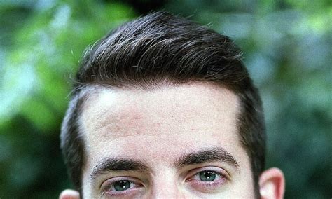 Uneven Hairline and Hair Loss - Will I Go Bald?