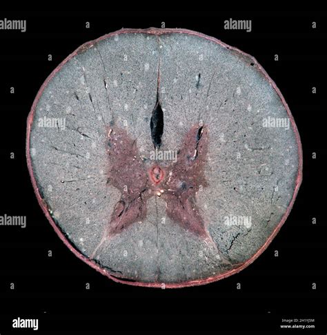 Sezione Del Midollo Spinale Immagini E Fotografie Stock Ad Alta