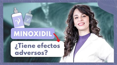 Minoxidil Qu Es C Mo Se Toma Tiene Efectos Adversos Dermat Loga