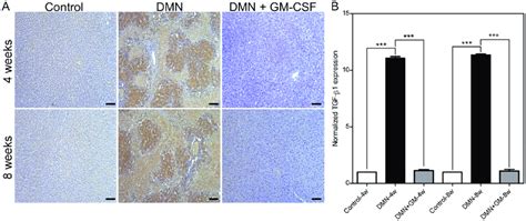 Effects Of Gm Csf On Dmn Induced Tgf β1 Expression A Representative