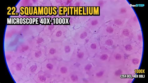 Squamous Epithelial Cheek Cells Labeled