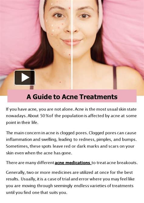 Ppt A Guide To Acne Treatments Powerpoint Presentation Free To Download Id 9645db N2fln