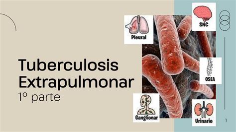 Tuberculosis Extrapulmonar Jairo Enriquez Udocz