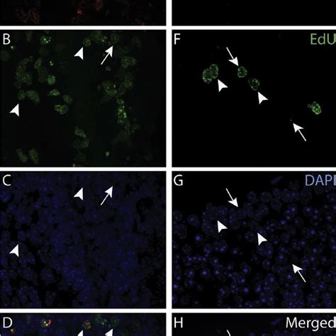 Pdf Edu A New Thymidine Analogue For Labelling Proliferating Cells