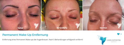 Permanent Make up Entfernung Augenbrauen LASER ÄSTHETIK INSTITUT