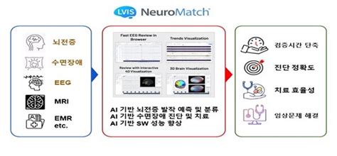 대구시 ‘ai기반 뇌발달질환 디지털의료기기 실증사업 공모 선정 일요신문