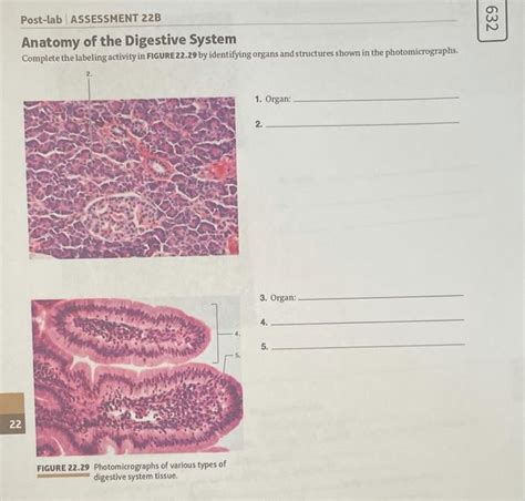 Solved Post Lab Assessment B Anatomy Of The Digestive Chegg