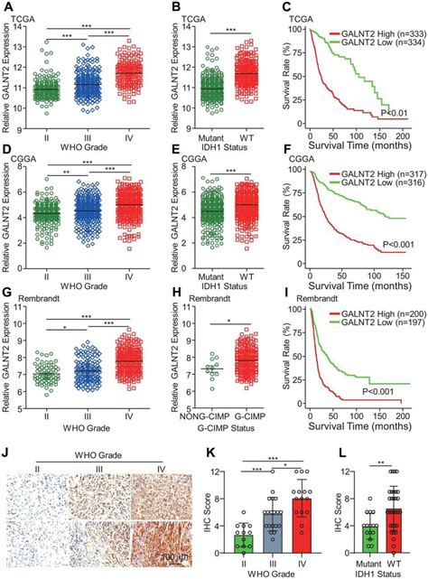 Galnt Expression Was Highly Expressed In Gbm And Idh Wildtype Gbm